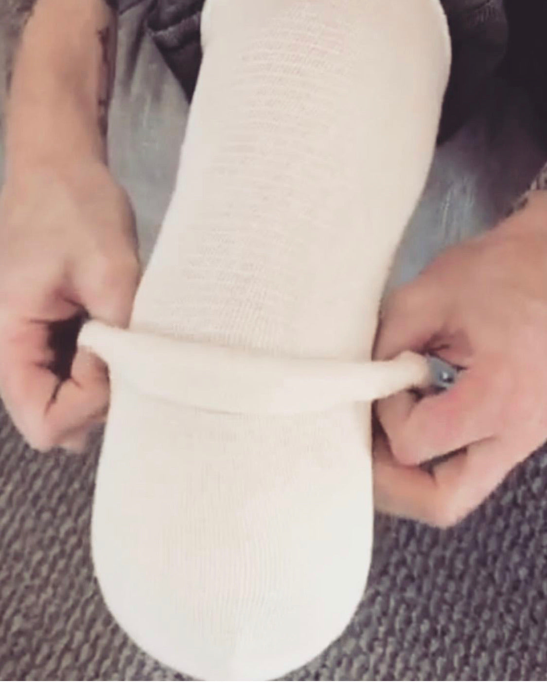 SOLO® Amputation Bandage